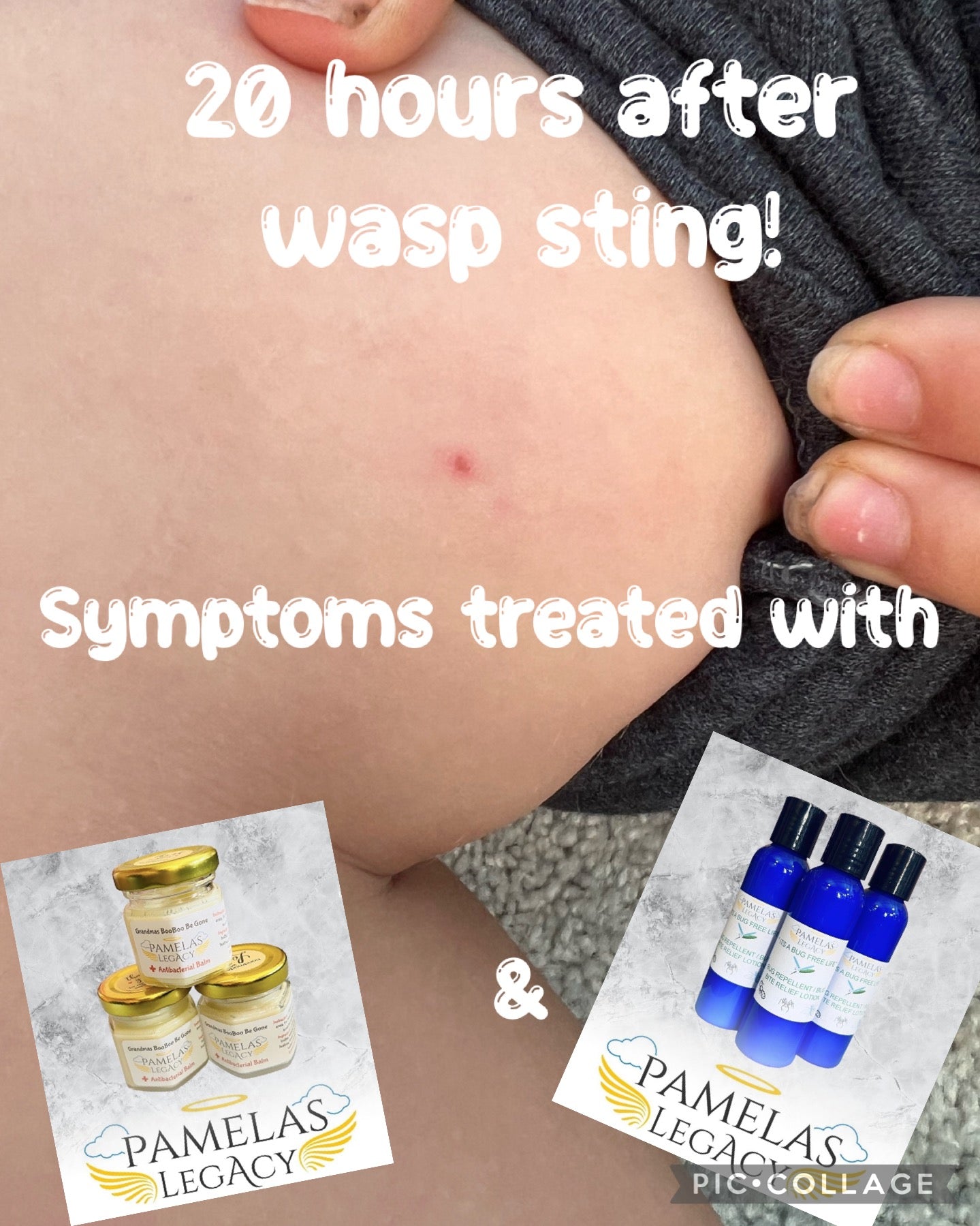 Its a Bug Free Life (Bug Repellant, Insect bite/sting Relief)